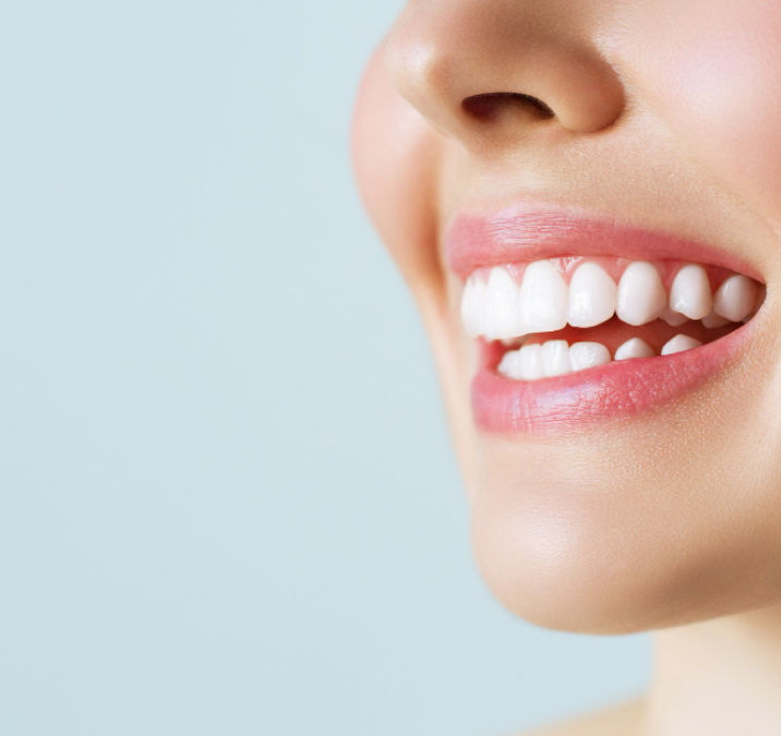 White teeth